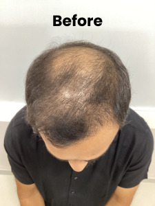Hair-1 (1)