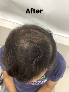 Hair-1 (2)