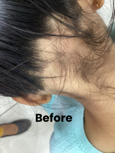 Hair Growth 1