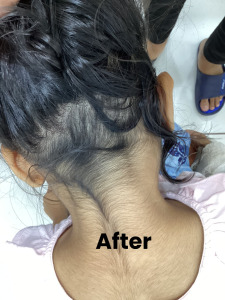 Hair Growth 2