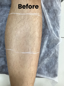 Leg LHR-1 (1)