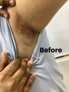 Under arm 1 (1)