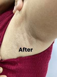 Under arm 1 (2)