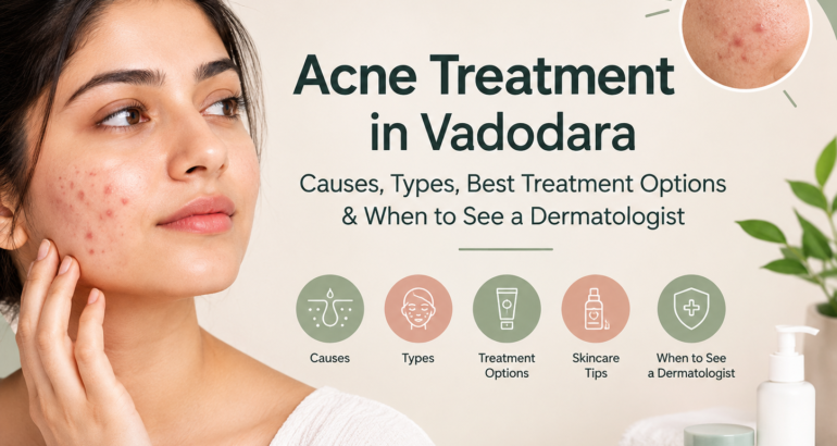 Acne Treatment in Vadodara: Causes, Types, Best Treatment Options & When to See a Dermatologist